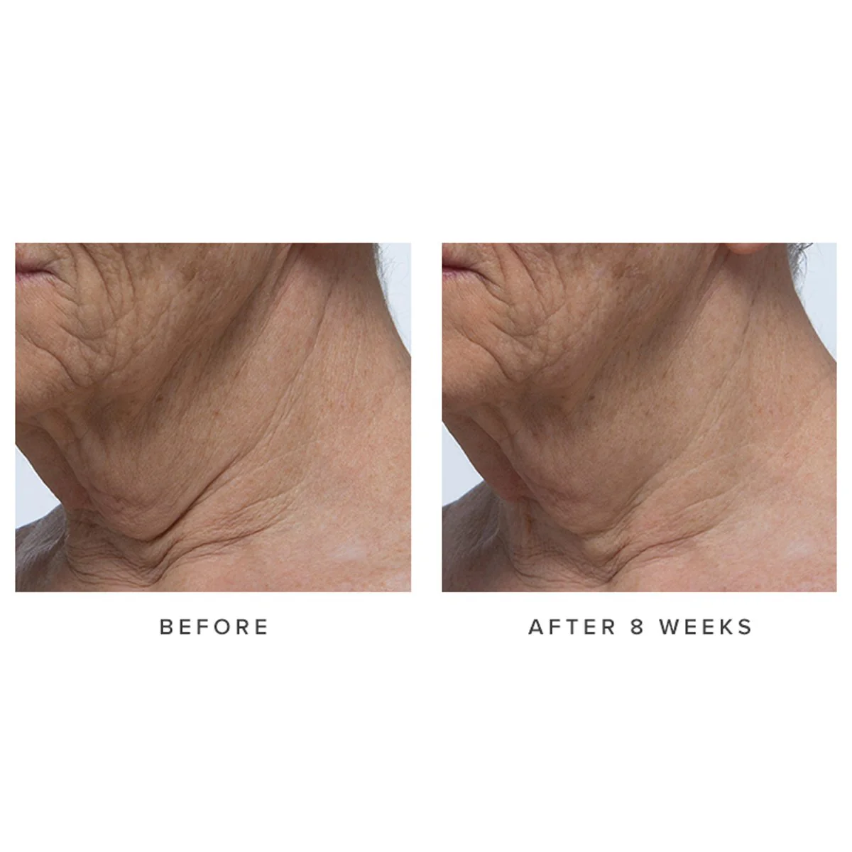 Ageless Revitalizing Neck Cream - Image 4