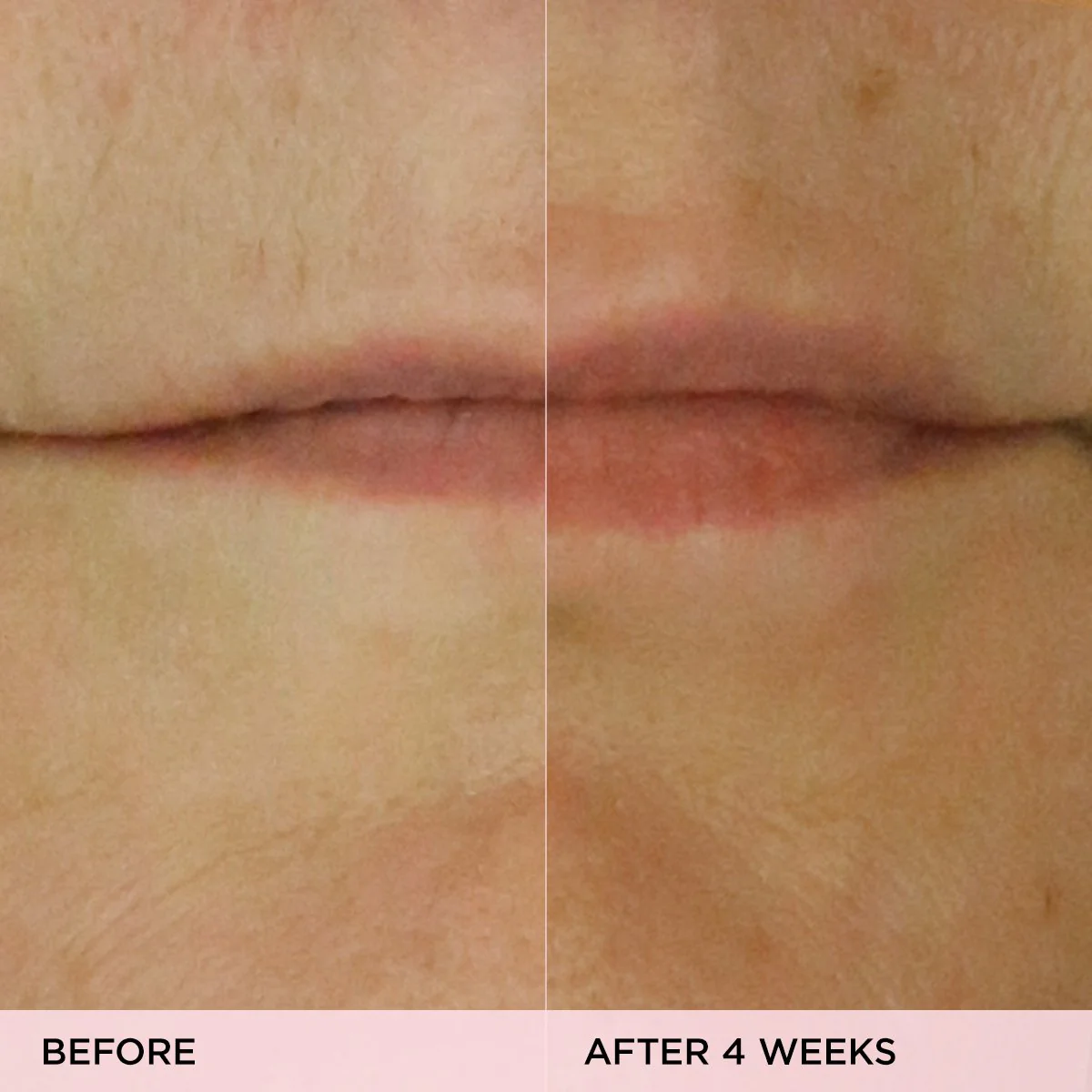The Kissu Lip Treatment - Image 5